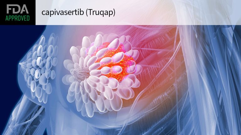 First AKT Inhibitor Permitted for Advanced Breast Most cancers